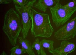 RPA2, p Ser33 Antibody, Novus Biologicals 100 &mu;L | Buy Online | Novus Biologicals | Fisher Scientific